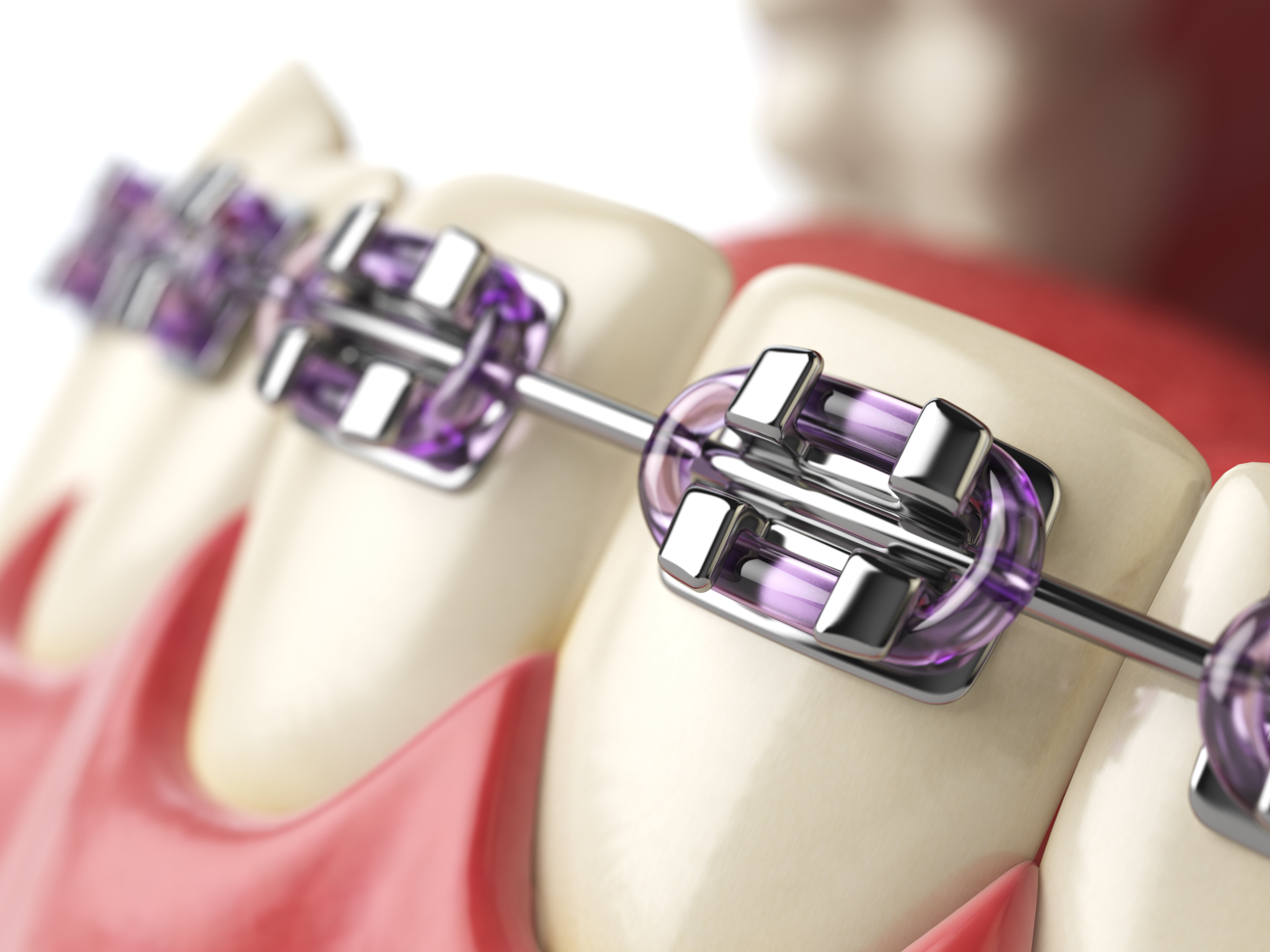 Orthodontics - image